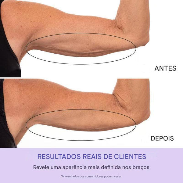 Firmeza Soul: O Tratamento Queridinho das Influencers para Braços Firmes sem Esforço!