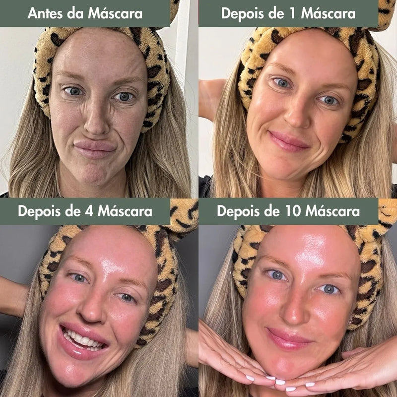 DermaGlow Botox+ - Máscara de colágeno + Ativo Botox